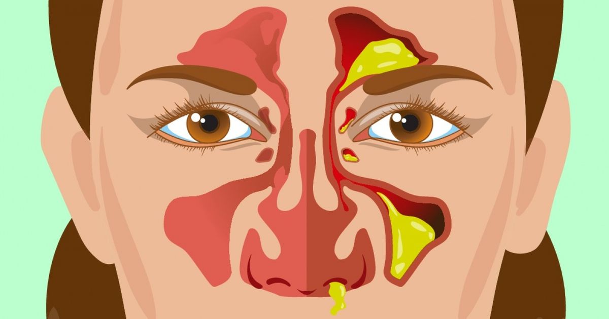 9 Dados sobre a secreção nasal que indicam como está sua saúde Incrível