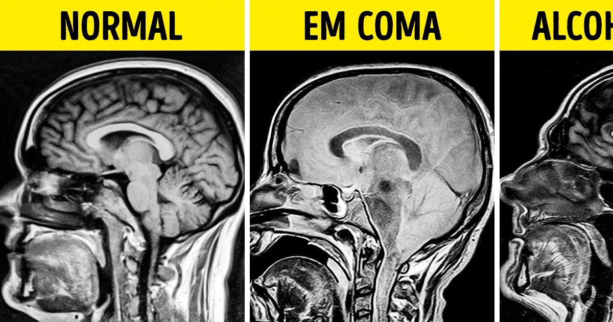 18 Radiografias Que Ajudam A Conhecer O Corpo Tanto Quanto Um Livro De