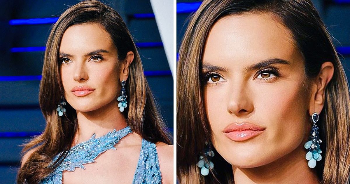 10 Celebridades brasileiras que aprenderam a amar suas “imperfeições”