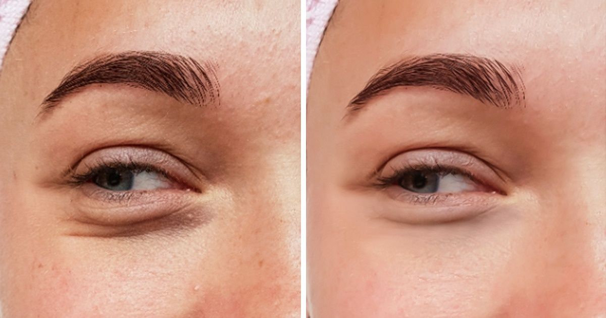 5 Sinais que podem indicar que você não está se movimentando o suficiente 5 Sinais que podem indicar que você não está se movimentando o suficiente