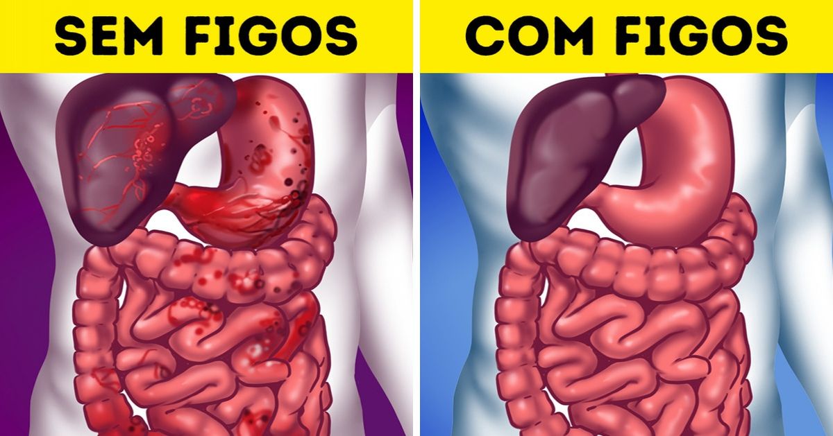 10 Razões para incluir figos na sua dieta 10 Razões para incluir figos na sua dieta
