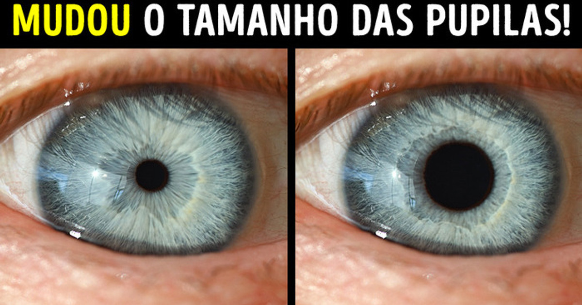Ele Pode Controlar o Tamanho das Pupilas + 10 Pessoas com Habilidades Incomuns