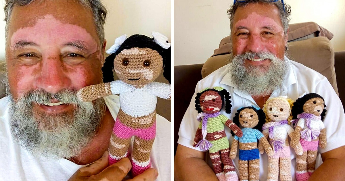 Vovô com vitiligo confecciona bonecas inclusivas para ajudar a devolver a autoestima das crianças Vovô com vitiligo confecciona bonecas inclusivas para ajudar a devolver a autoestima das crianças