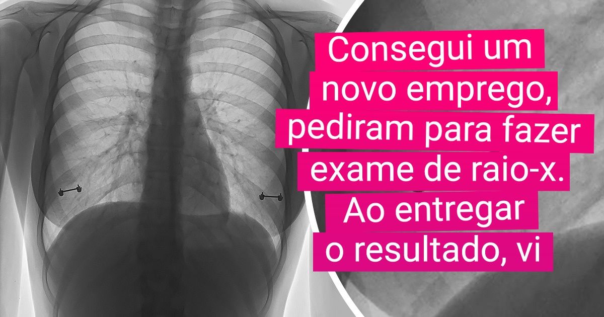 19 Coisas que a natureza não pode mostrar, mas um exame de raio-X pode 19 Coisas que a natureza não pode mostrar, mas um exame de raio-X pode
