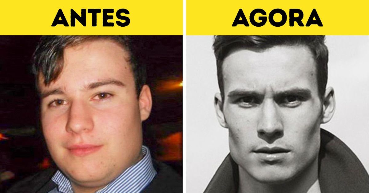 18 Patinhos feios que cresceram e viraram verdadeiros cisnes