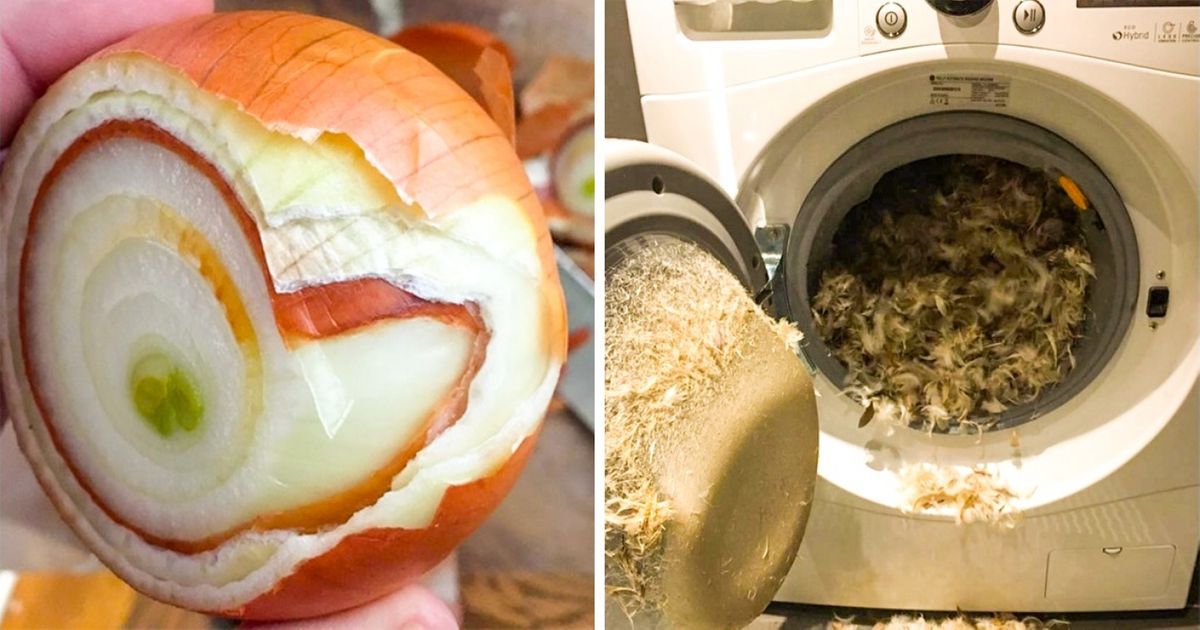 21 Pessoas que foram vítimas do azar no dia a dia