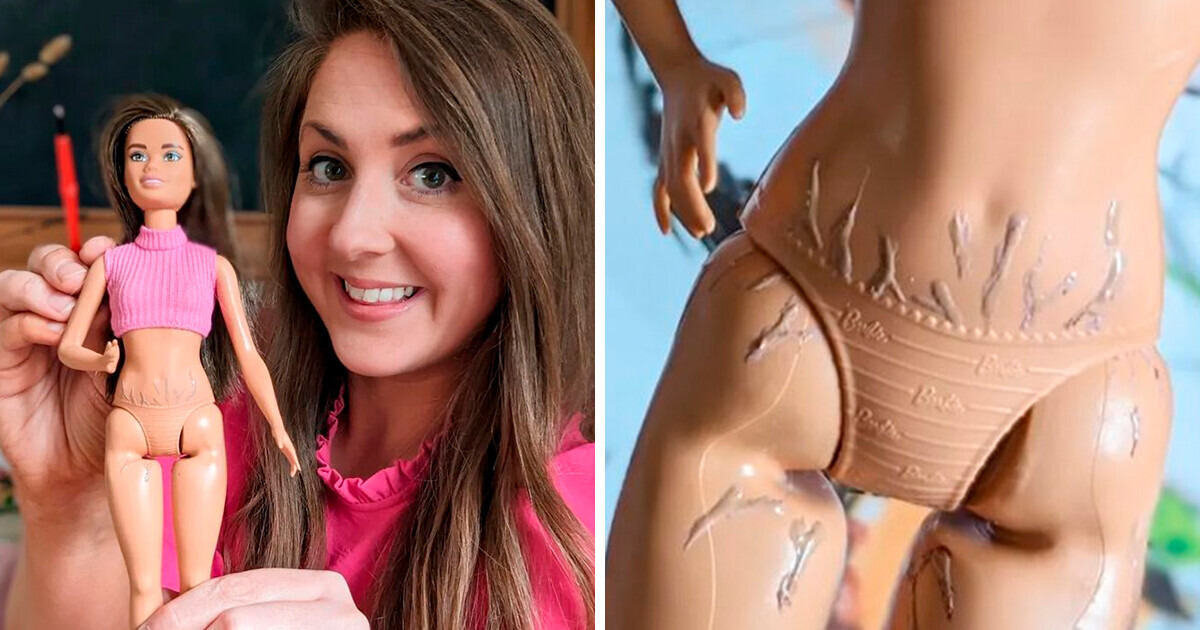 Uma mãe adapta boneca com estrias para ensinar aceitação e é criticada Uma mãe adapta boneca com estrias para ensinar aceitação e é criticada