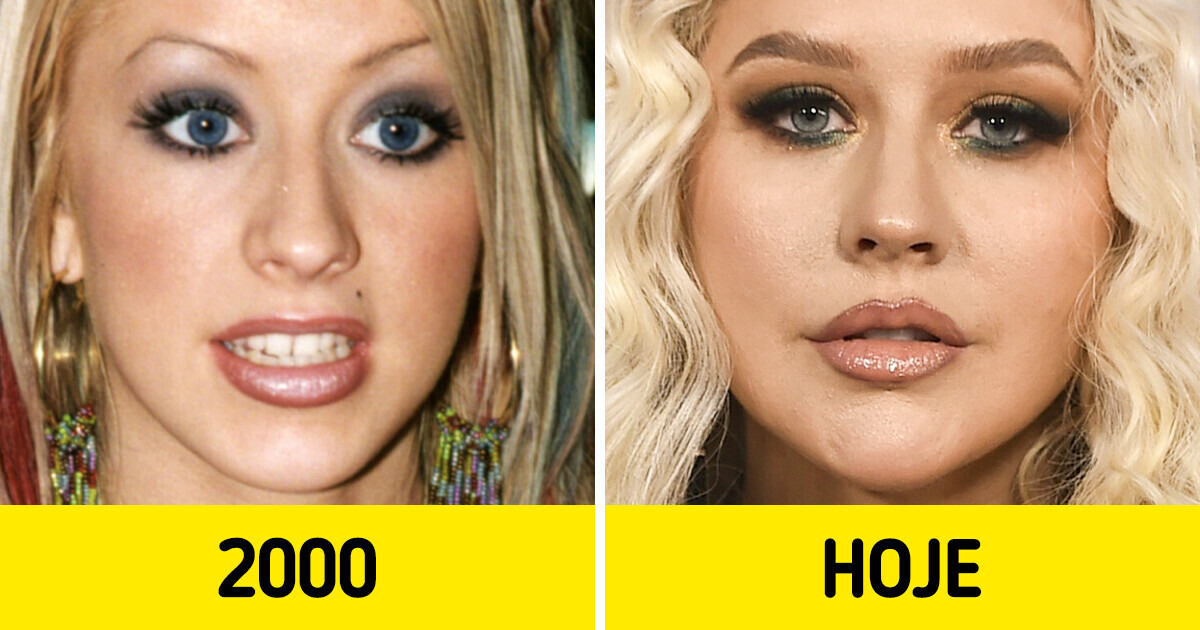 11 Closes de celebridades que mostram como seus rostos mudaram ao longo das décadas 11 Closes de celebridades que mostram como seus rostos mudaram ao longo das décadas