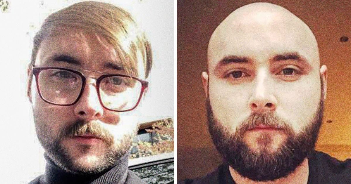 15+ Homens que decidiram dar uma chance à calvície e não voltaram atrás