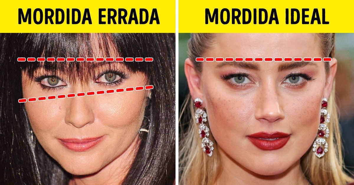 Como a mordida errada influencia nossa aparência e saúde