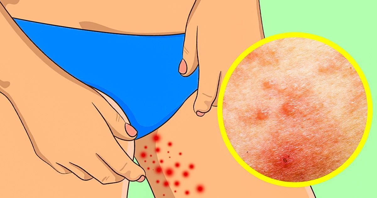 Como resolver alguns dos problemas que todos nós sofremos no verão