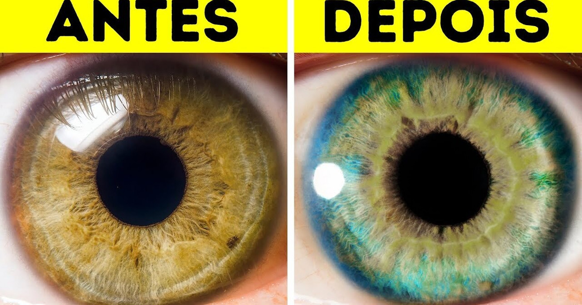 7 Coisas que podem mudar a cor dos seus olhos