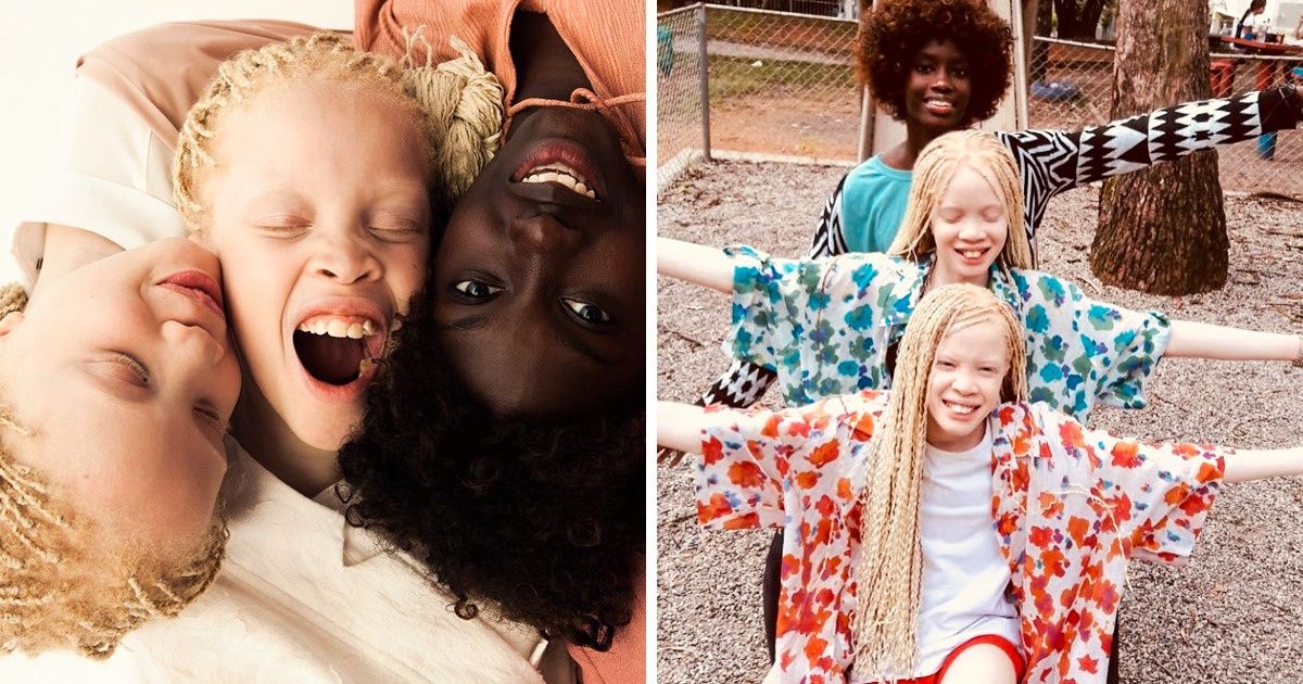 Irmãs brasileiras e albinas mostram que existem negros de vários tons e que a moda pode ser inclusiva Irmãs brasileiras e albinas mostram que existem negros de vários tons e que a moda pode ser inclusiva