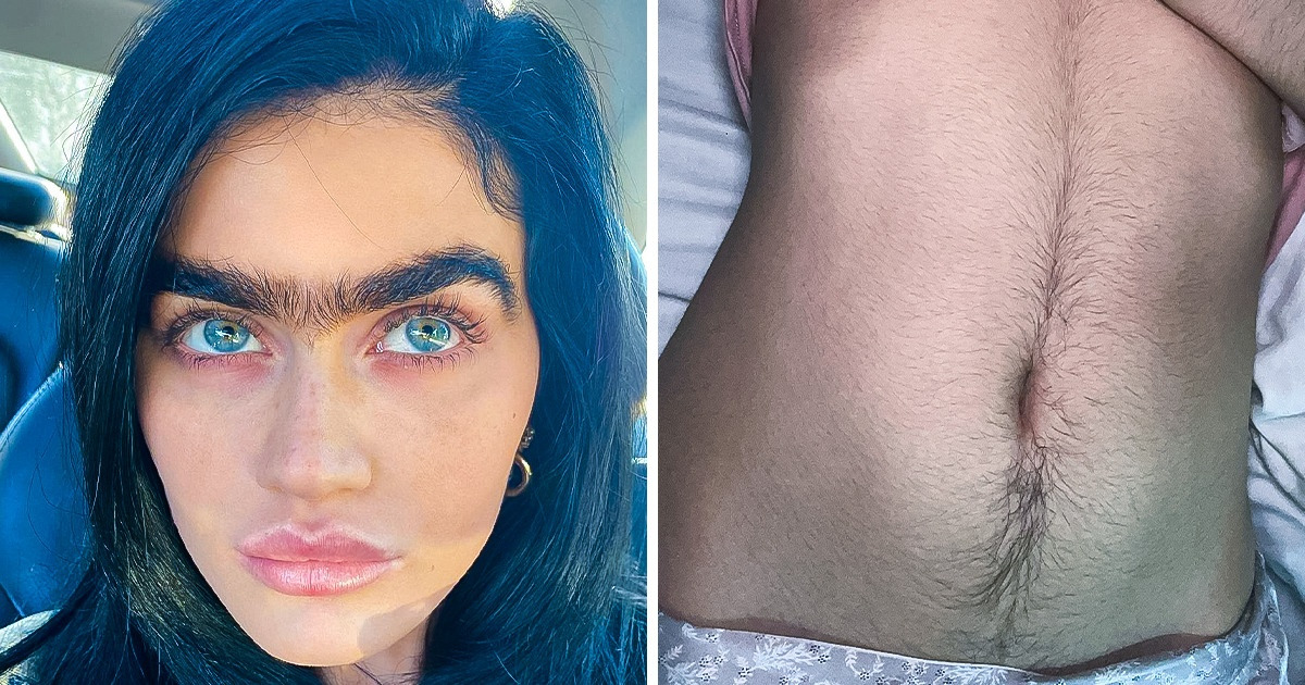 12 Mulheres corajosas que decidiram viver completamente livres da depilação 12 Mulheres corajosas que decidiram viver completamente livres da depilação
