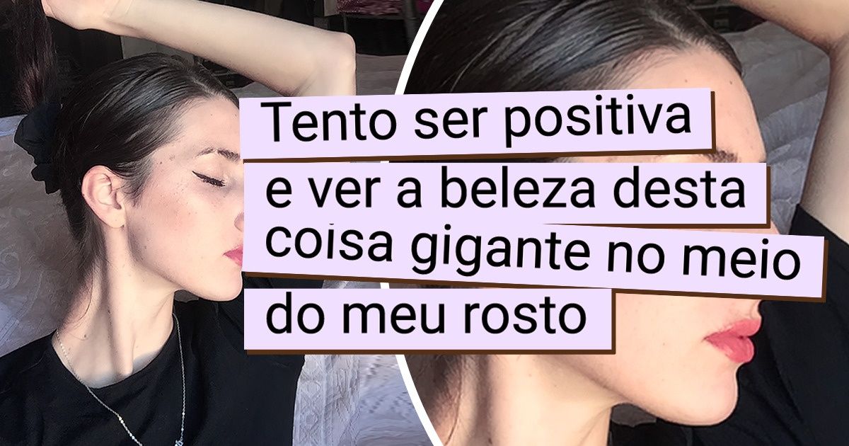 16 Pessoas que decidiram abraçar sua aparência e viver uma vida plena 16 Pessoas que decidiram abraçar sua aparência e viver uma vida plena