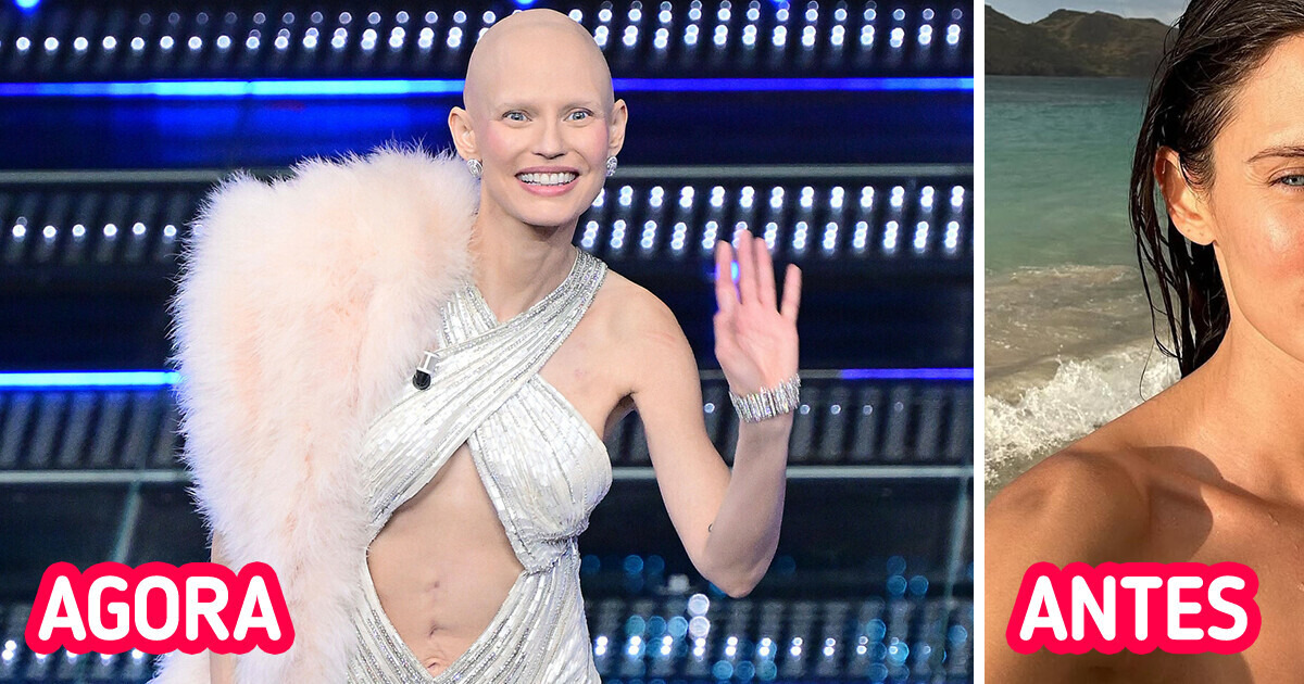 Top model italiana enfrenta câncer de ovário e emociona ao apresentar festival: 'Estou aqui para celebrar a vida' Top model italiana enfrenta câncer de ovário e emociona ao apresentar festival: 'Estou aqui para celebrar a vida'