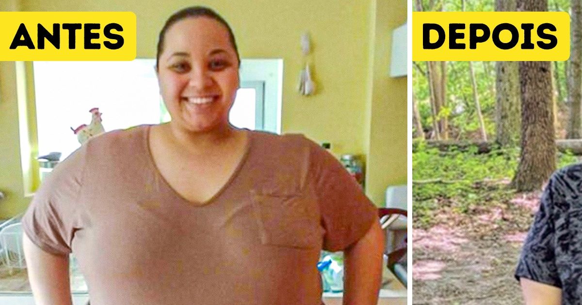 20 Pessoas que perderam peso de maneira incrível 20 Pessoas que perderam peso de maneira incrível