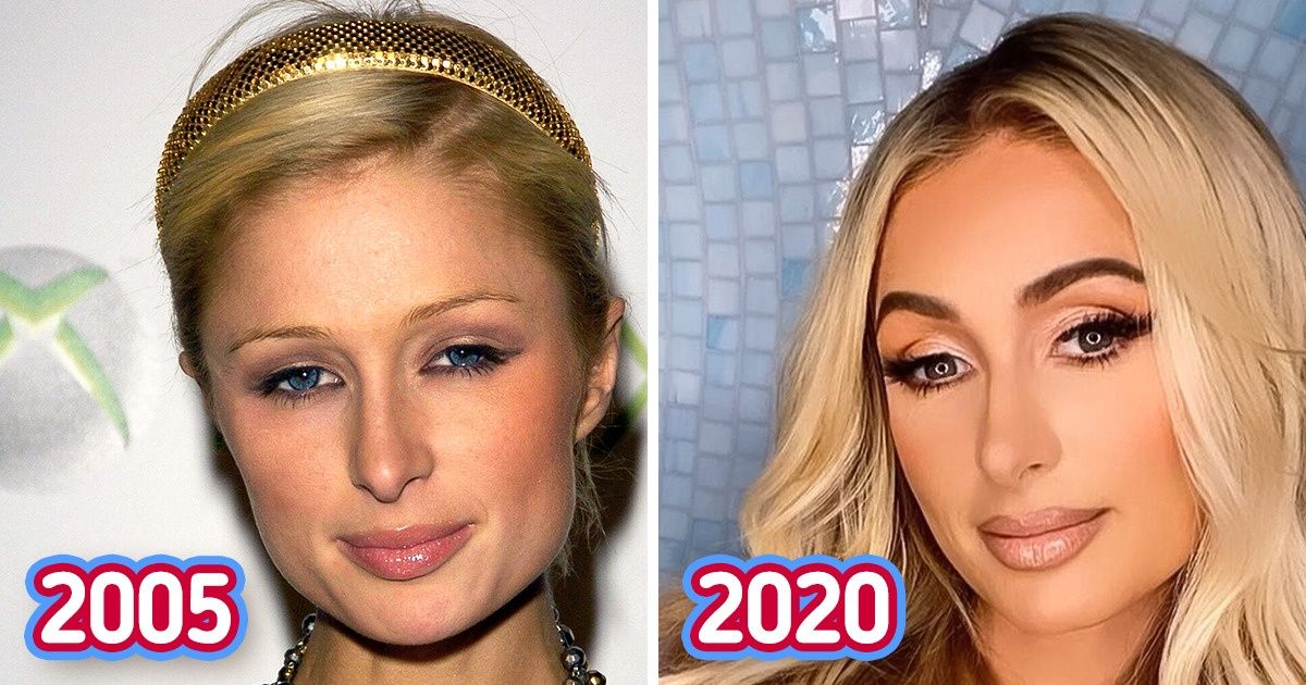 16 Comparações que provam que as sobrancelhas podem transformar o rosto mais do que uma cirurgia plástica