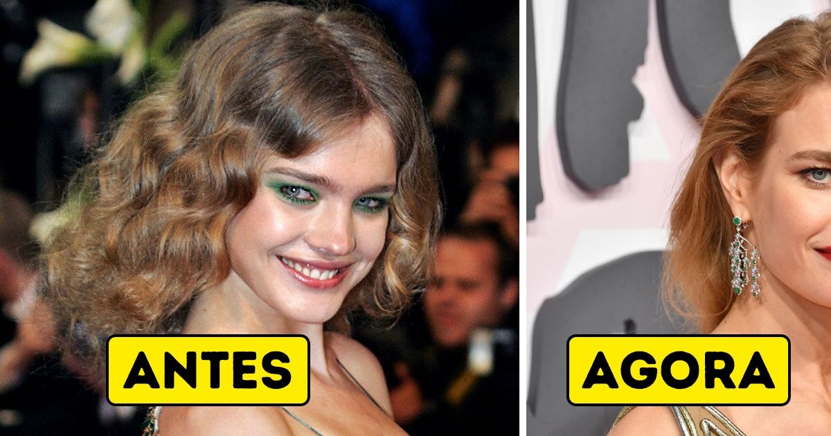 A supermodelo Natalia Vodianova sabe o que é ser pobre, e por isso doa milhões de dólares para obras de caridade A supermodelo Natalia Vodianova sabe o que é ser pobre, e por isso doa milhões de dólares para obras de caridade