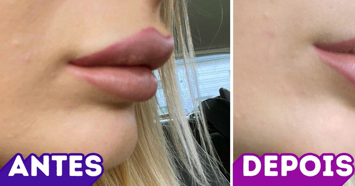 18 Garotas que seguiam a moda para se sentirem mais bonitas, mas mudaram de ideia