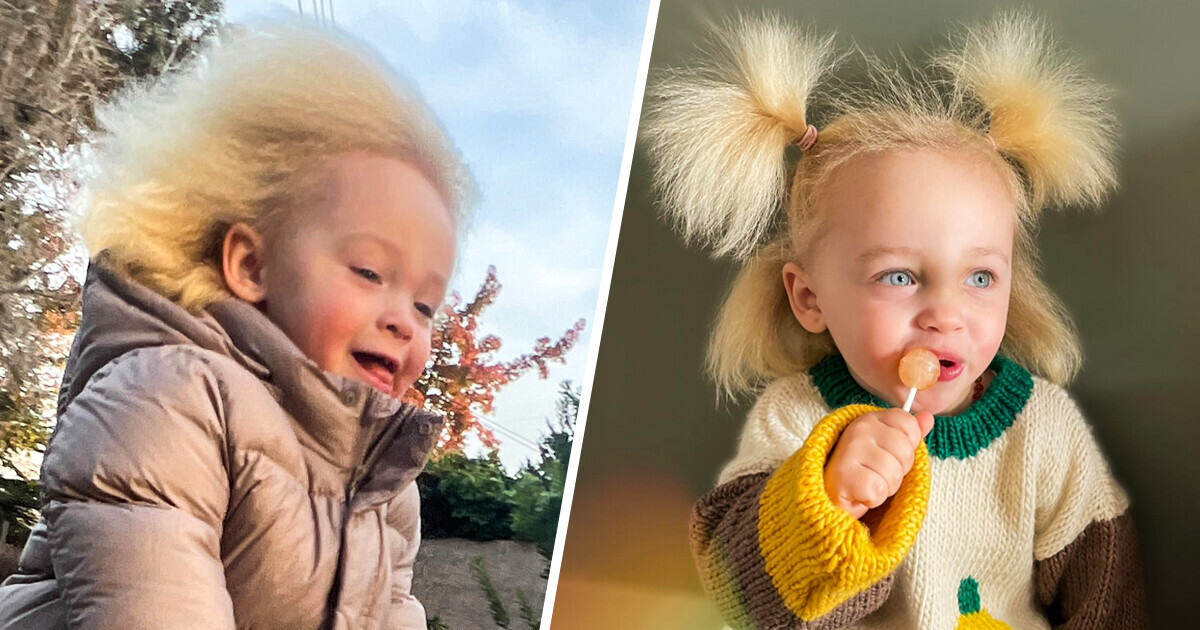 Essa menina encantou o mundo com cabelo que ninguém consegue pentear Essa menina encantou o mundo com cabelo que ninguém consegue pentear