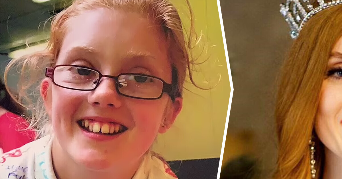 Garota superou bullying na escola pela sua aparência e agora é Miss Inglaterra