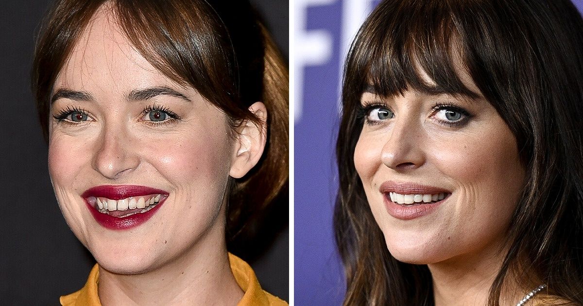 15 Celebridades que repaginaram os dentes e ficaram com o sorriso ainda mais deslumbrante 15 Celebridades que repaginaram os dentes e ficaram com o sorriso ainda mais deslumbrante
