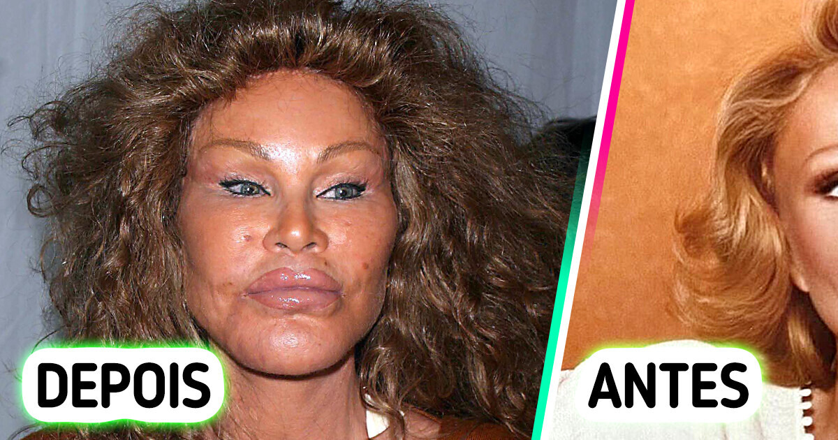 Foto inédita de “mulher-gato” antes das cirurgias estéticas intriga e fascina público Foto inédita de “mulher-gato” antes das cirurgias estéticas intriga e fascina público