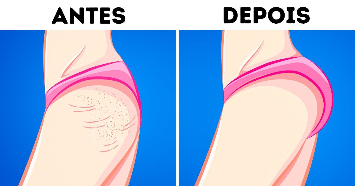 10 Exercícios simples que ajudarão a moldar os glúteos