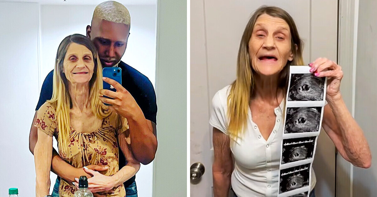 Desafiando expectativas: Mulher de 63 anos anuncia gravidez com marido de 26 anos