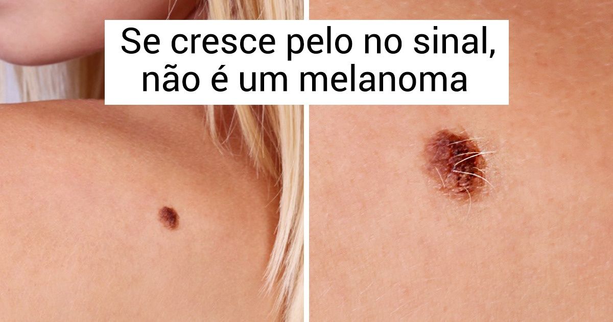 7 Boas notícias para quem tem medo de sofrer com câncer 7 Boas notícias para quem tem medo de sofrer com câncer