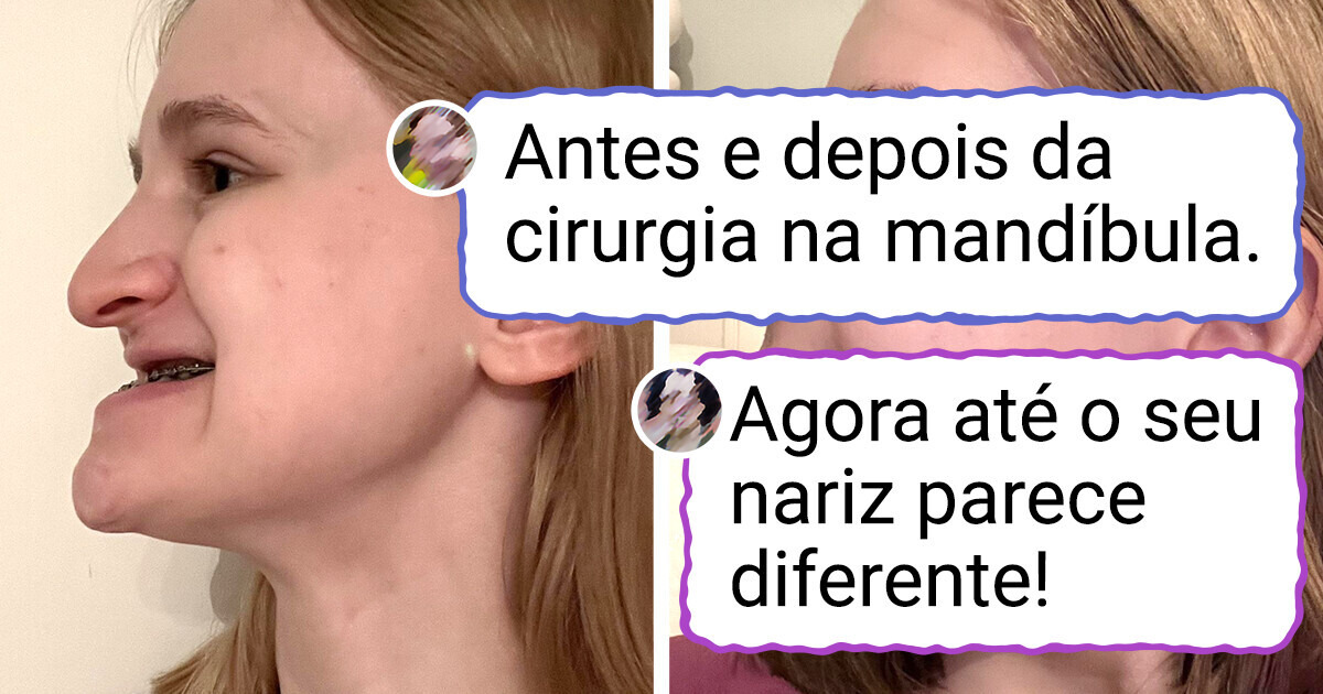 15+ Pessoas que mudaram um detalhezinho e fizeram a internet perguntar: 'O que aconteceu com você?