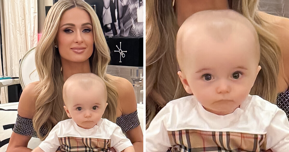 Paris Hilton compartilha foto com o filho e preocupa fãs: “Leve-o a um neurocirurgião”