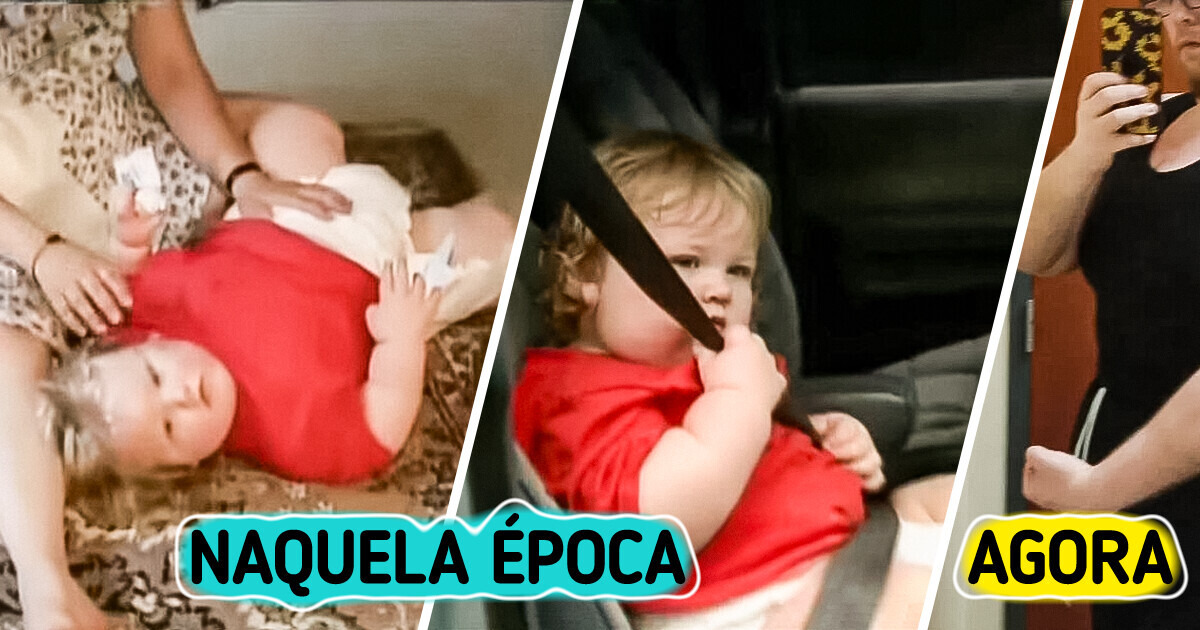 Como está o bebê de 32 kg agora, 27 anos após aparecer em programas de TV