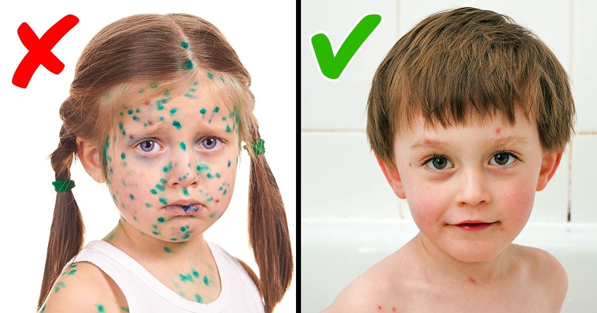 7 Mitos sobre saúde infantil em que muitos pais ainda acreditam