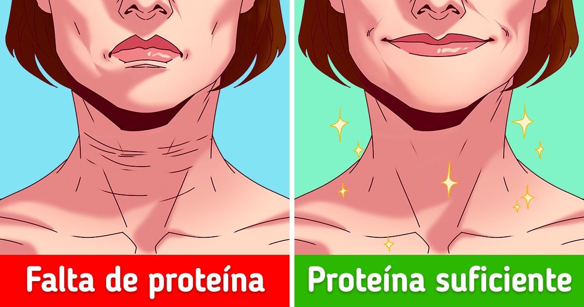 6 Fatores que podem resultar em rugas na sua pele