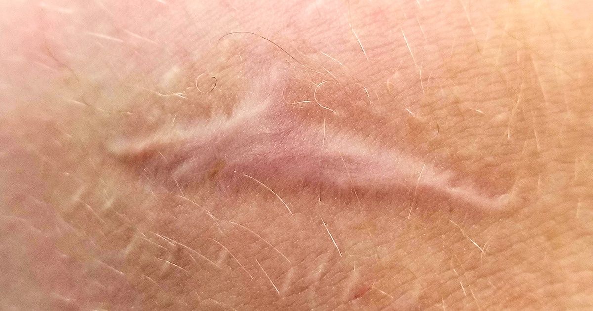 20 Fenômenos espetaculares que aconteceram por pura casualidade