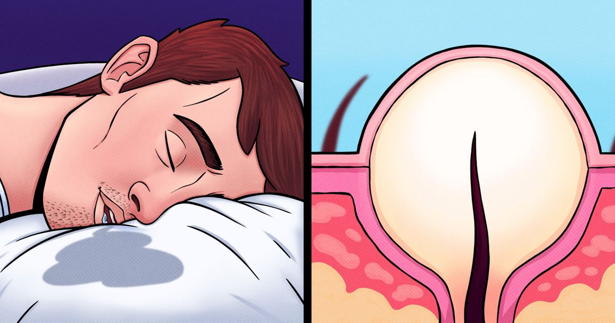 10 Coisas cotidianas que estão arruinando secretamente sua pele