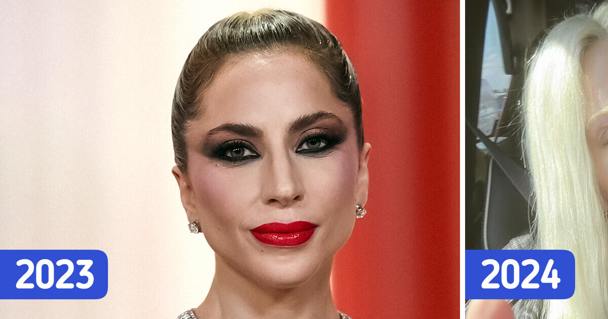 A última foto de Lady Gaga está causando alvoroço devido à sua notável transformação A última foto de Lady Gaga está causando alvoroço devido à sua notável transformação