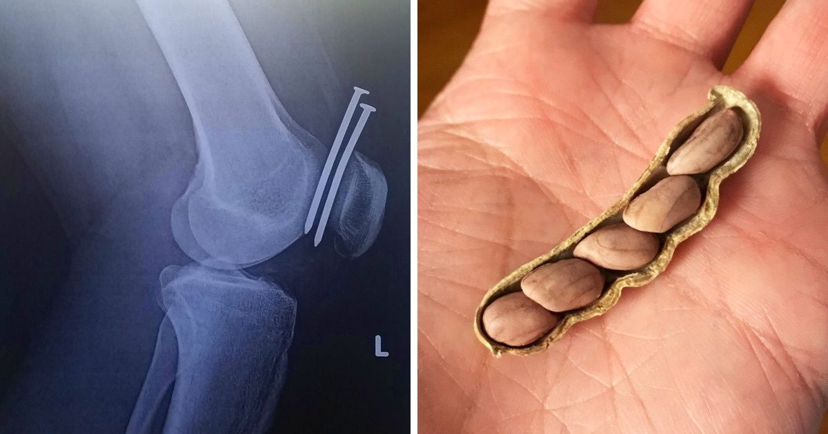 Situações inusitadas que acontecem apenas uma vez na vida