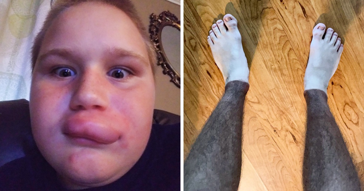 15 Pessoas que conhecem o verdadeiro significado do termo “azarado” 15 Pessoas que conhecem o verdadeiro significado do termo “azarado”