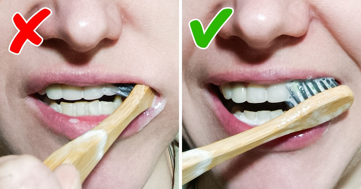 6 Pecados dentários que podem te custar um canal