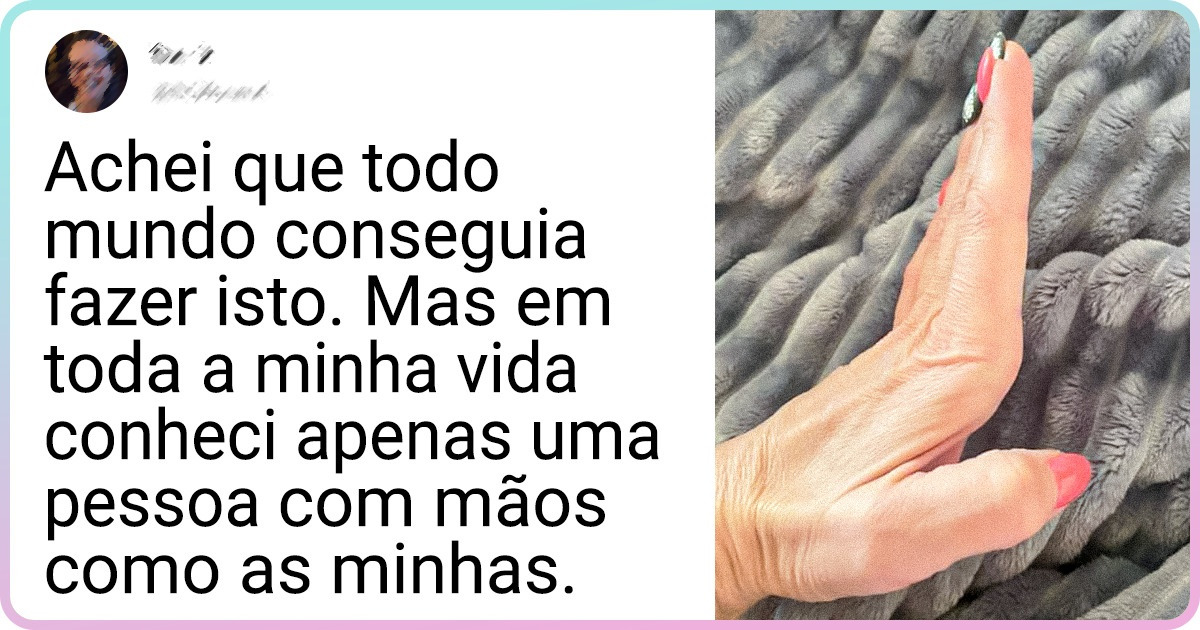 16 Pessoas que não têm receio em compartilhar suas características fora do comum