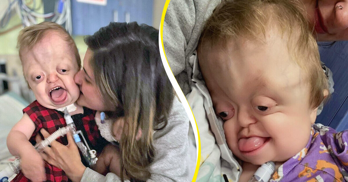 Apenas posto fotos do meu filho, mas a reação das pessoas é implorar que eu pare Apenas posto fotos do meu filho, mas a reação das pessoas é implorar que eu pare