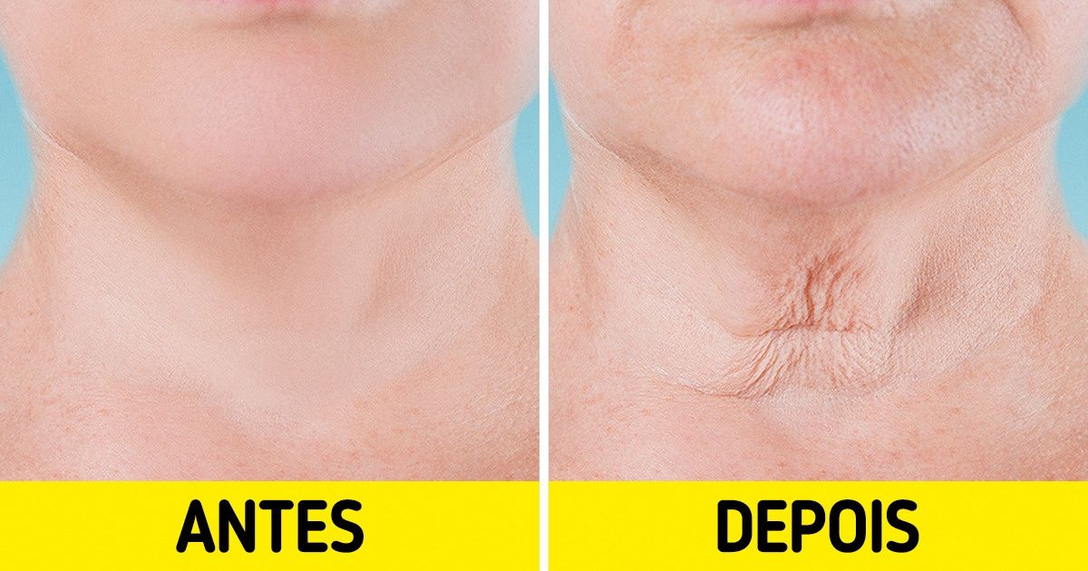 7 Partes do corpo que podem revelar a sua idade 7 Partes do corpo que podem revelar a sua idade
