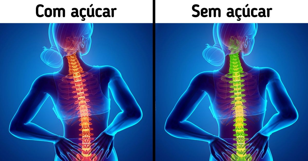 O que pode acontecer com o corpo de quem corta totalmente o açúcar O que pode acontecer com o corpo de quem corta totalmente o açúcar
