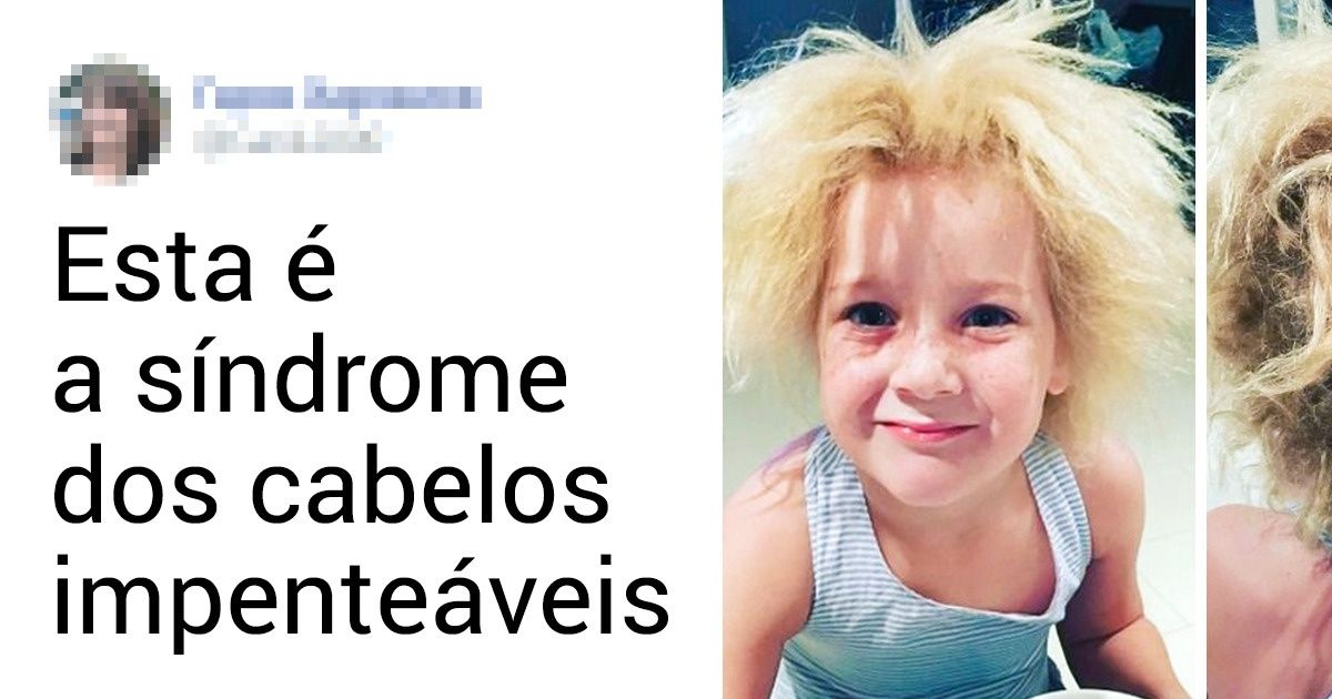 20+ Pessoas com aparências excêntricas, mas que decidiram criar o próprio padrão de beleza