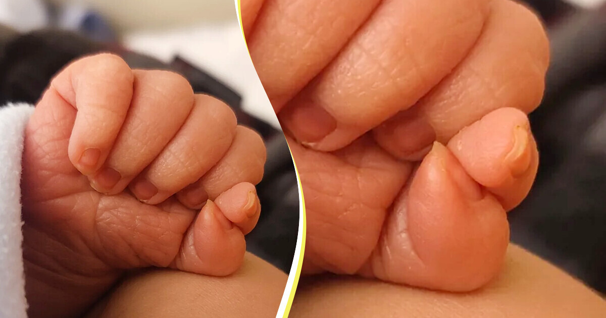 12 Vezes em que o corpo humano demonstrou ter uma criatividade extraordinária 12 Vezes em que o corpo humano demonstrou ter uma criatividade extraordinária