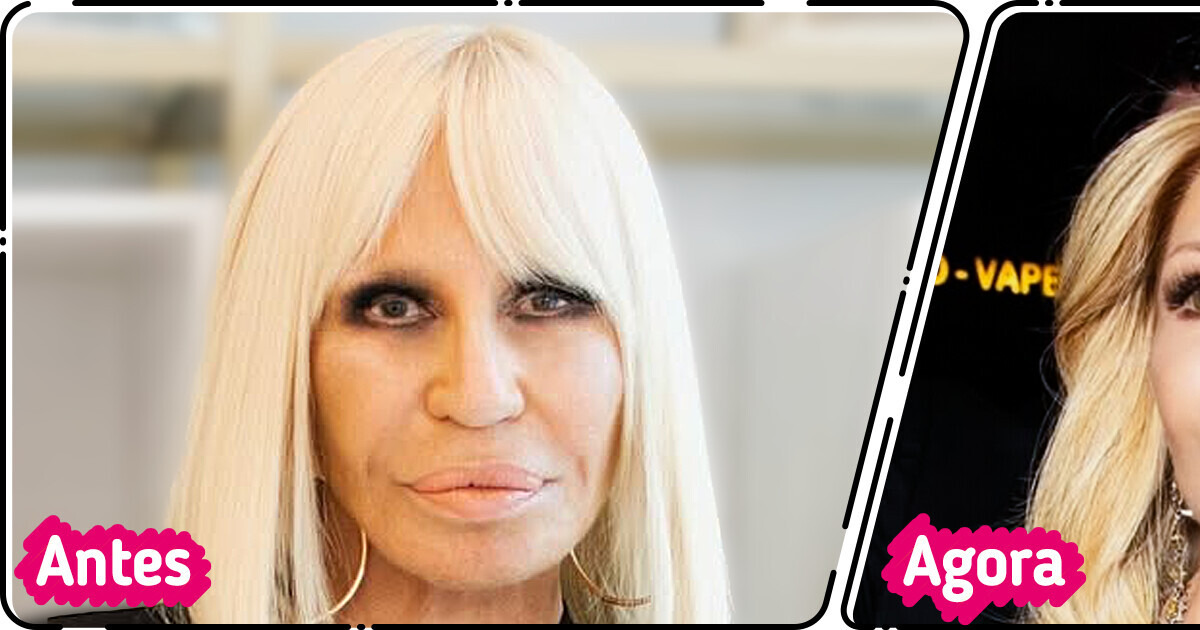 “Esse médico merece o prêmio Nobel!” Novo visual de Donatella Versace causa alvoroço na Internet “Esse médico merece o prêmio Nobel!” Novo visual de Donatella Versace causa alvoroço na Internet