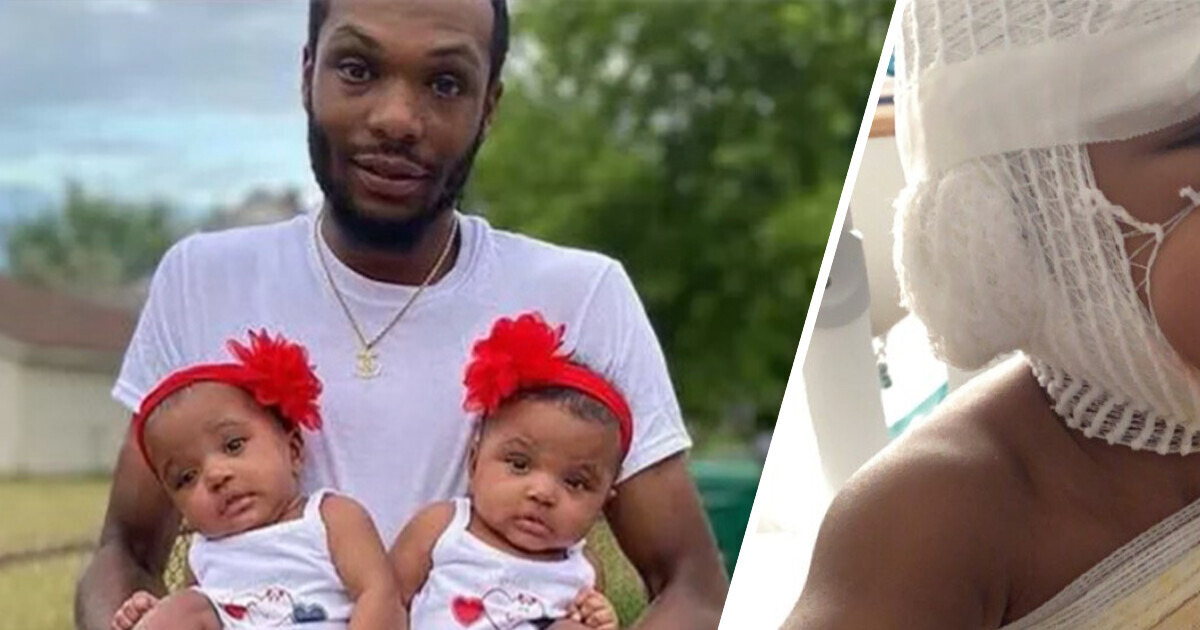 Pai herói perdeu tudo o que tinha para salvar suas gêmeas de 18 meses de um incêndio